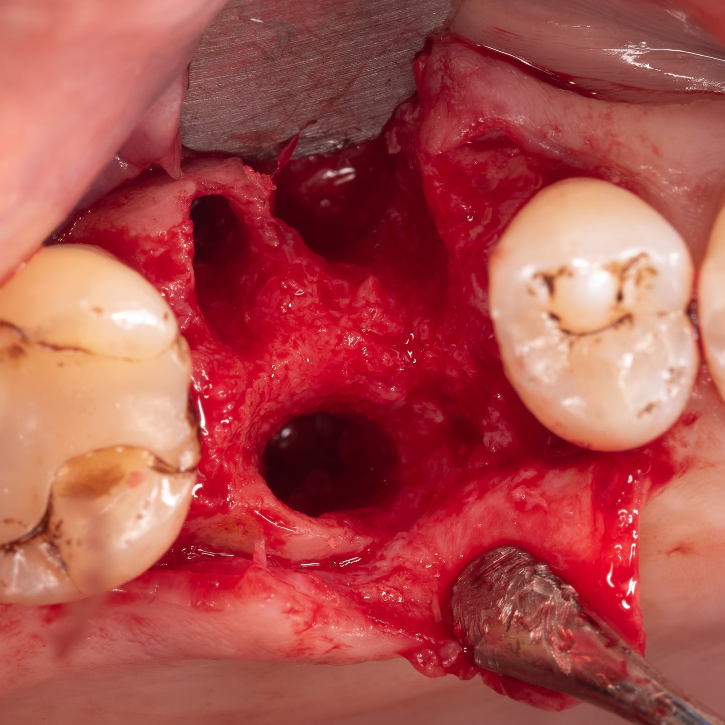 September 28, 2024 - Pig Mandible Extractions and Bone Grafting Hands-On