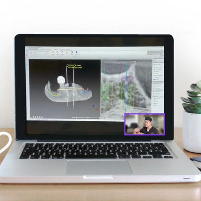 Image of a Apple MacBook showing a Zoom meeting. Dr. Jonathan Ng is in the lower right corner explaining the digital planning for implant placements on the majority of the computer screen
