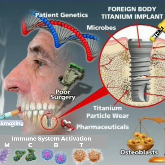  Profile of a man's face with transparent cheek, showcasing teeth and a dental implant in the jaw. Magnified image of the implant in bone with microbes and titanium particles. Larger image of DNA with "patient genetics." Images of cells under "immune system activation." Capsules labeled "pharmaceuticals." Scale with osteoblasts in the lower right