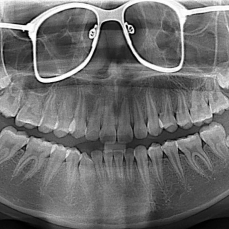 Panoramic radiograph taken while the patient is wearing his or her glasses