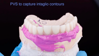 Two Course Bundle: Implant Prosthetic Complications by Dr. Goth Sui and Prosthetic Complications: Implants and Natural Teeth by Dr. Jonathan Ng