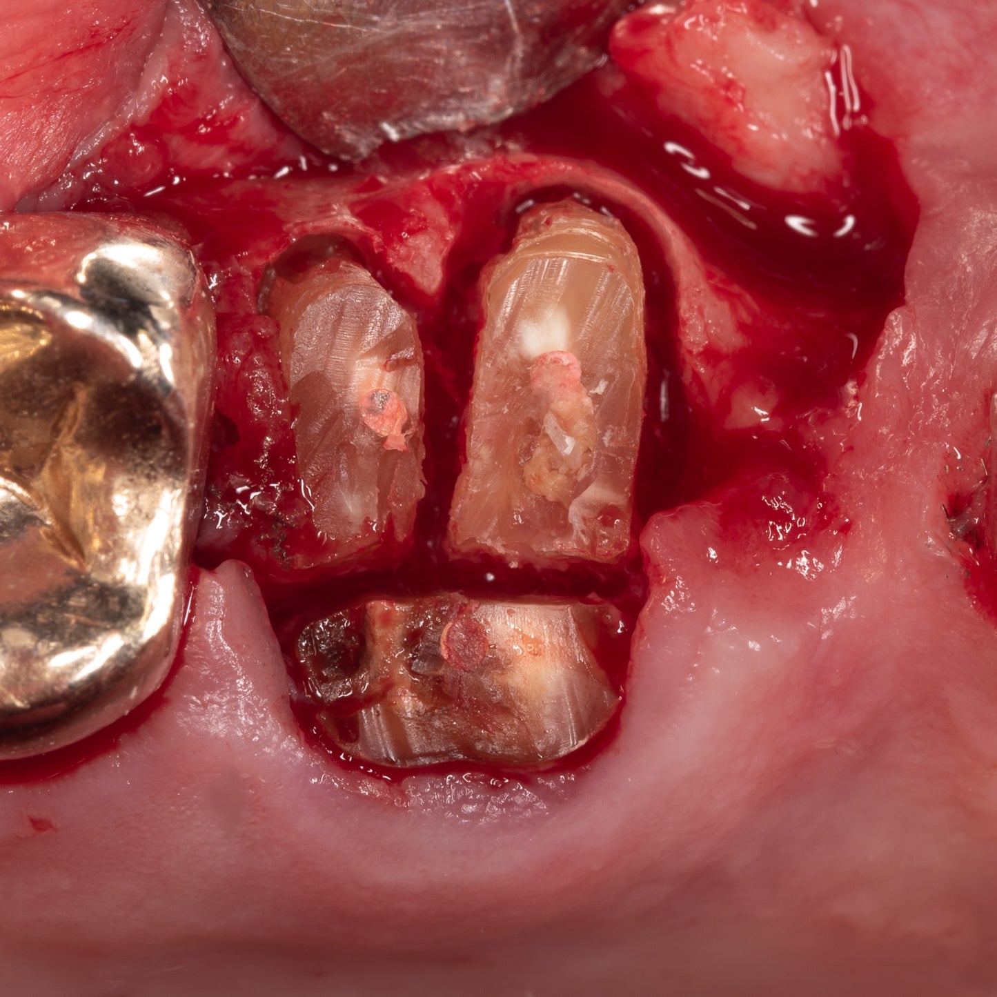 Image of sectioned roots of an upper molar tooth with preserved bone